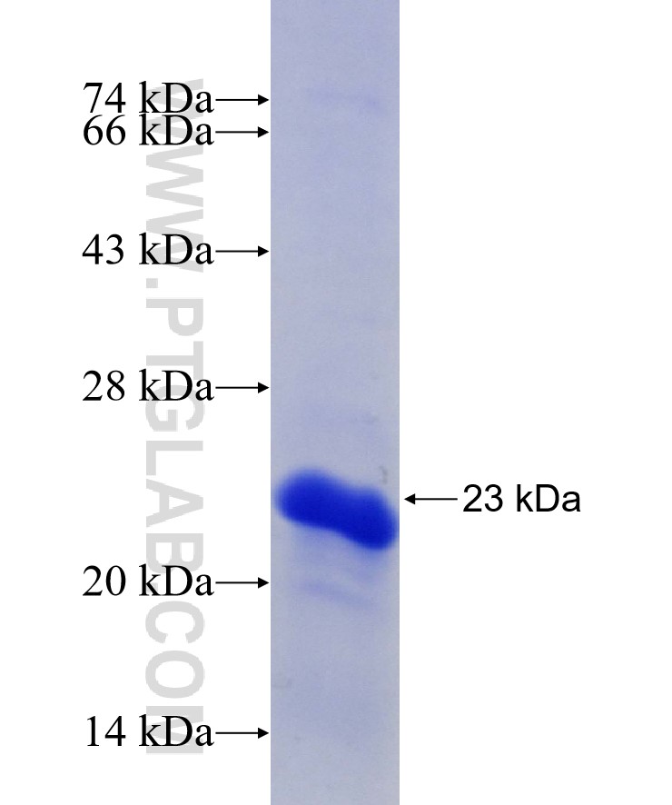 DCPS fusion protein Ag29493 SDS-PAGE