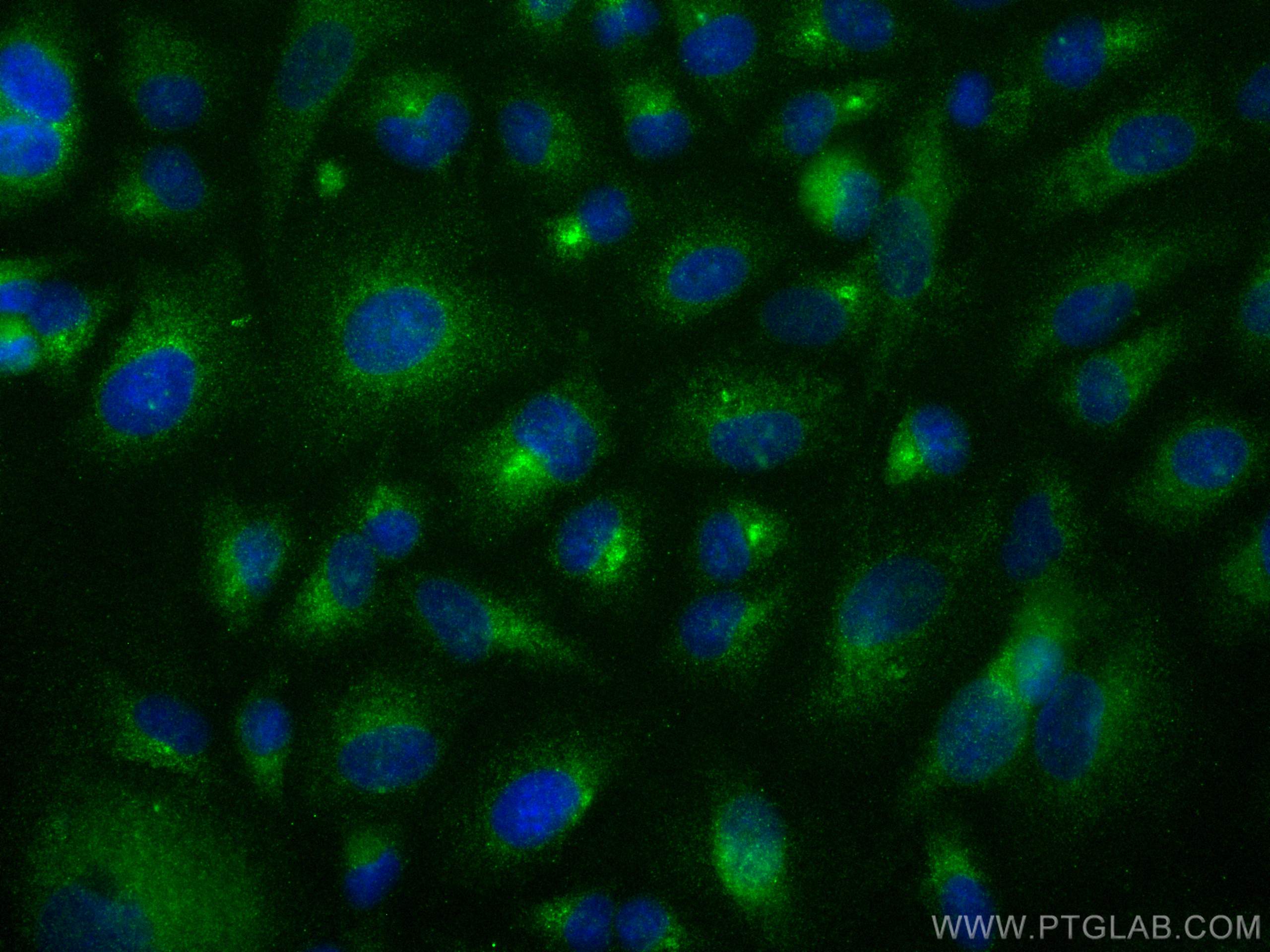 IF Staining of A549 using 13095-1-AP