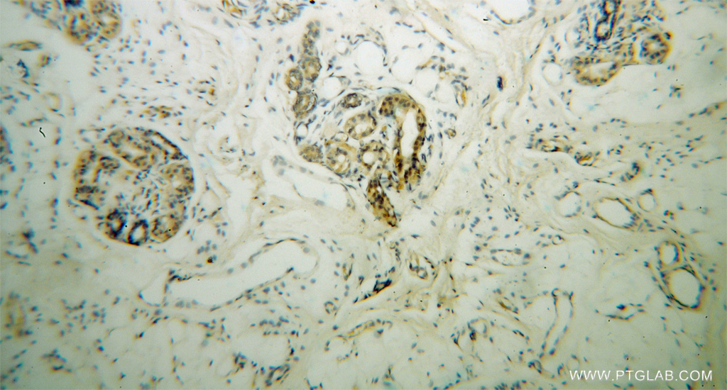 IHC staining of human skin using 13095-1-AP