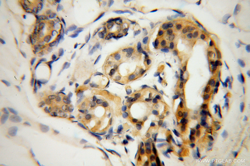 IHC staining of human skin using 13095-1-AP