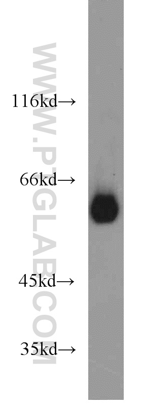 WB analysis of HL-60 using 13095-1-AP