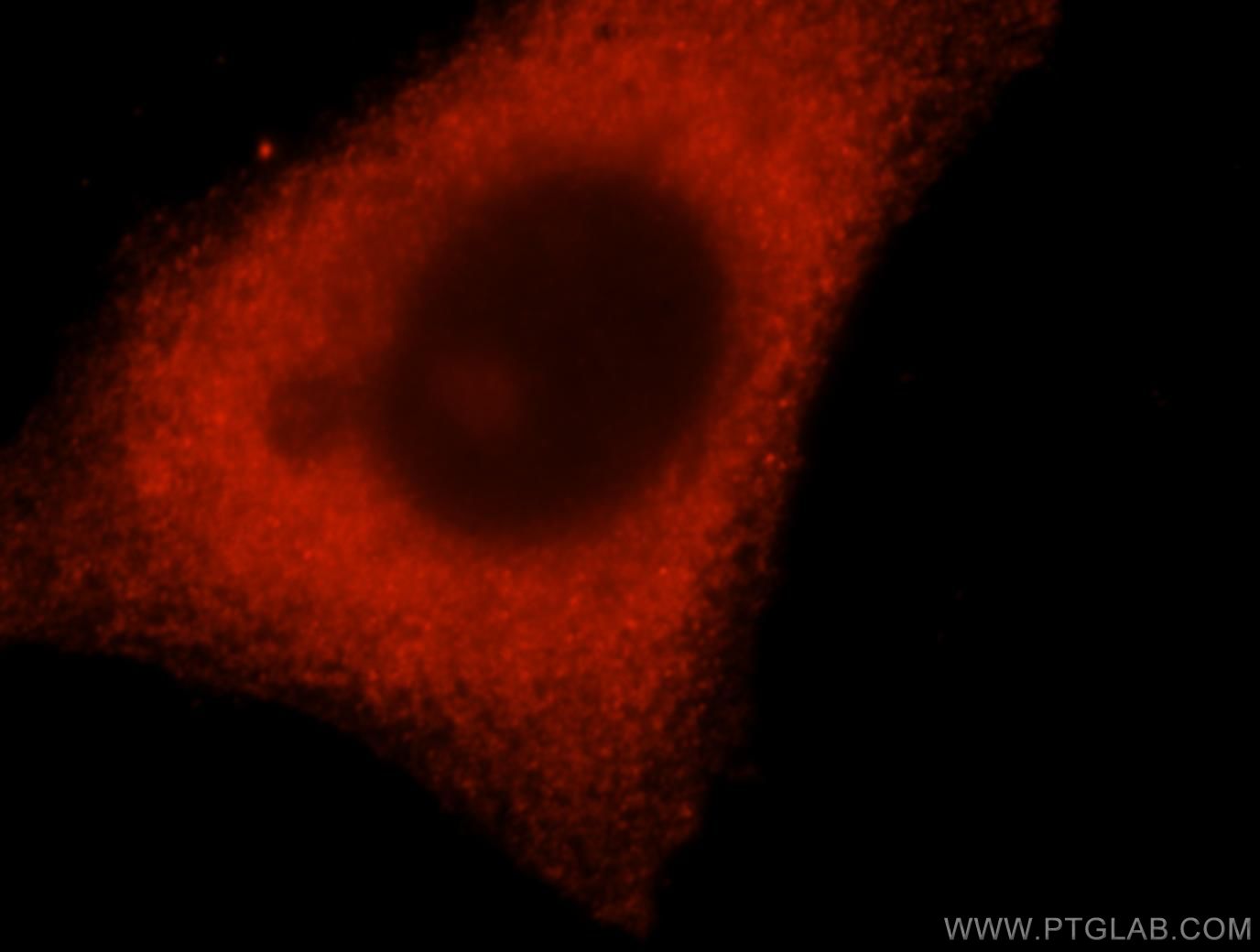 IF Staining of HepG2 using 16784-1-AP