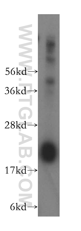 WB analysis of human brain using 16784-1-AP