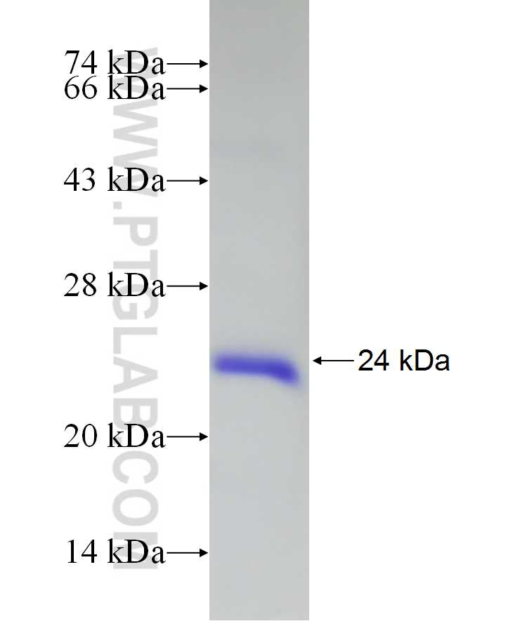 DCTD fusion protein Ag10245 SDS-PAGE