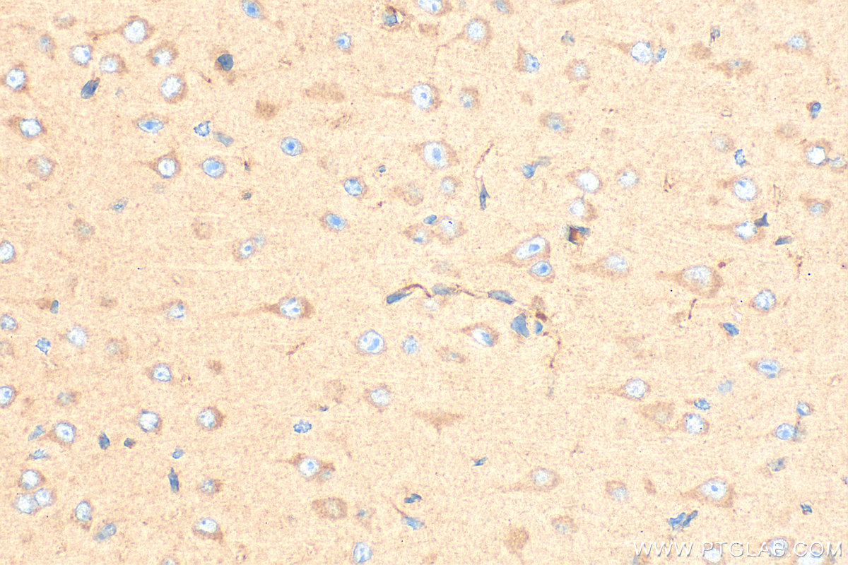 IHC staining of mouse brain using 11325-1-AP