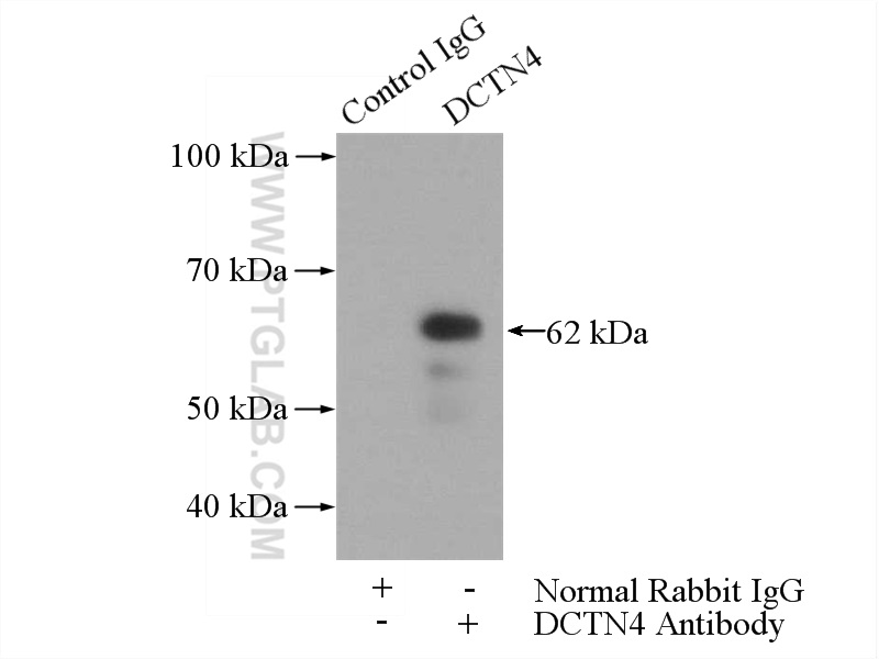 IP experiment of Jurkat using 17098-1-AP