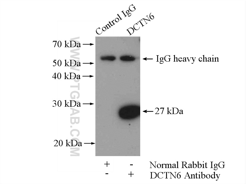 IP experiment of mouse testis using 16947-1-AP