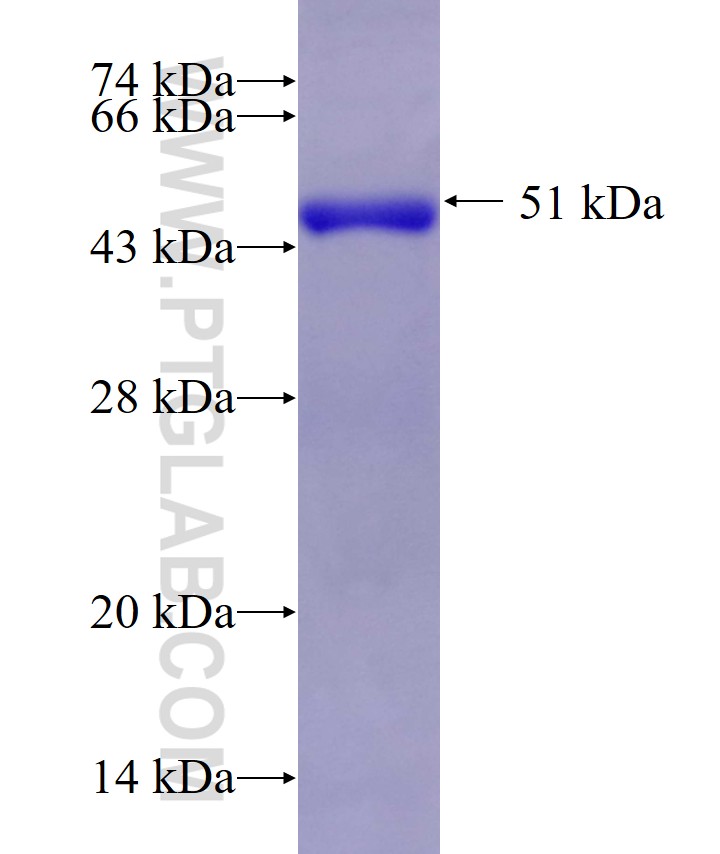 DCTN6 fusion protein Ag10561 SDS-PAGE