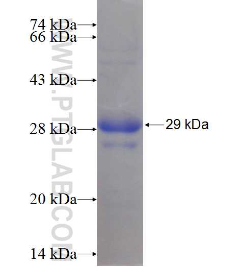 DCTN6 fusion protein Ag10652 SDS-PAGE DCTN6 fusion protein Ag10652 SDS-PAGE