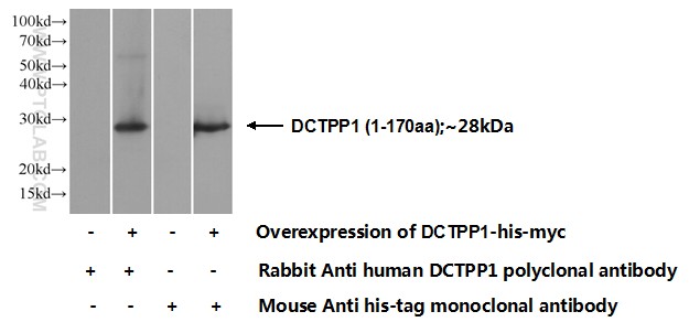 DCTPP1