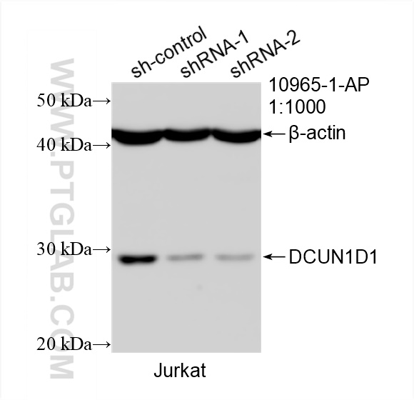 WB analysis of Jurkat using 10965-1-AP