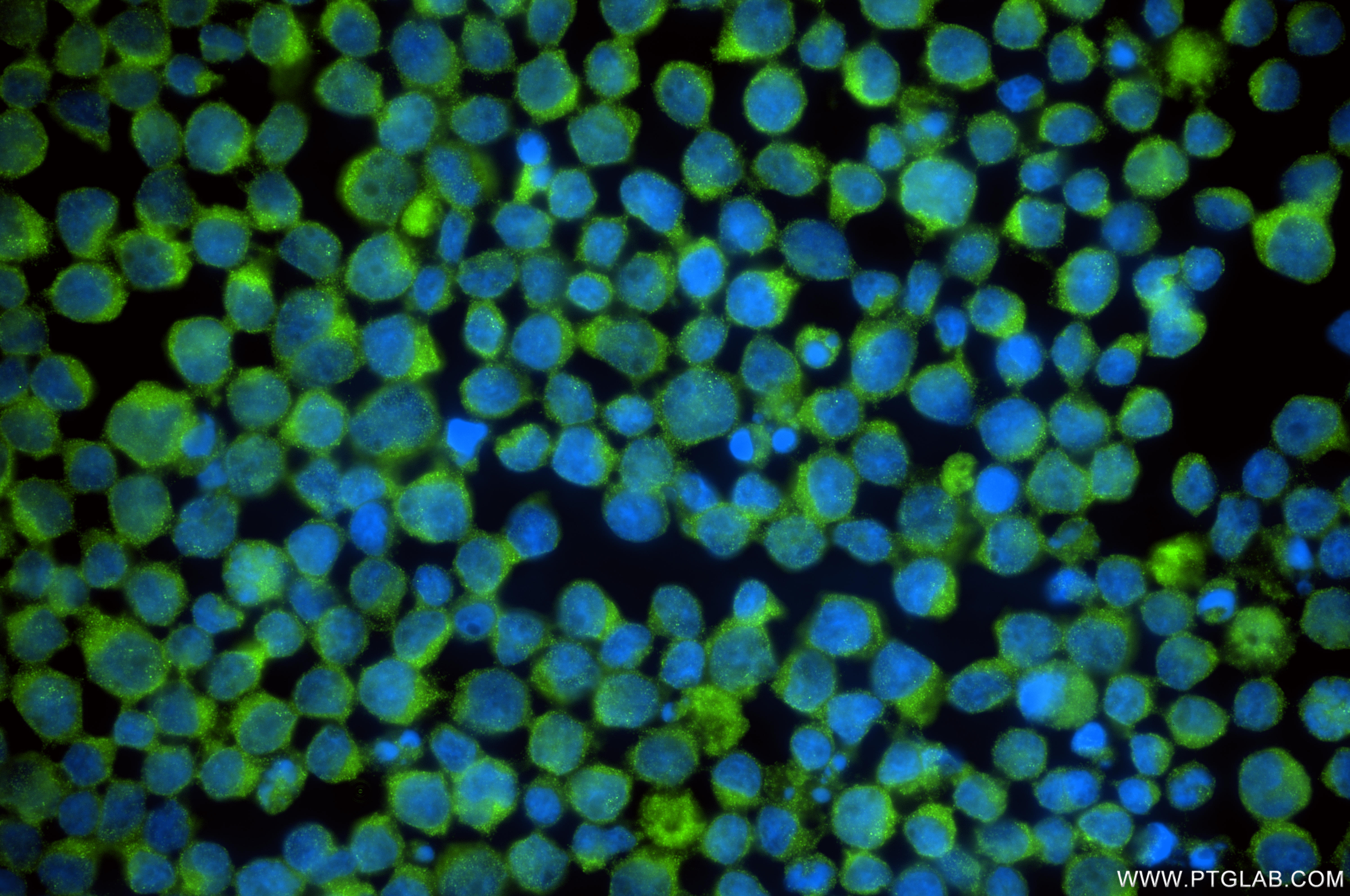 Immunofluorescent analysis of (4% PFA) fixed Jurkat cells using DCUN1D1 antibody (85849-4-RR, Clone: 250196B5 ) at dilution of 1:400 and CoraLite®488-Conjugated Goat Anti-Rabbit IgG(H+L) (<a class='green' href='/productredirect?CatalogNo=SA00013-2' target='_blank'>SA00013-2</a>). IF Staining of Jurkat using 85849-4-RR