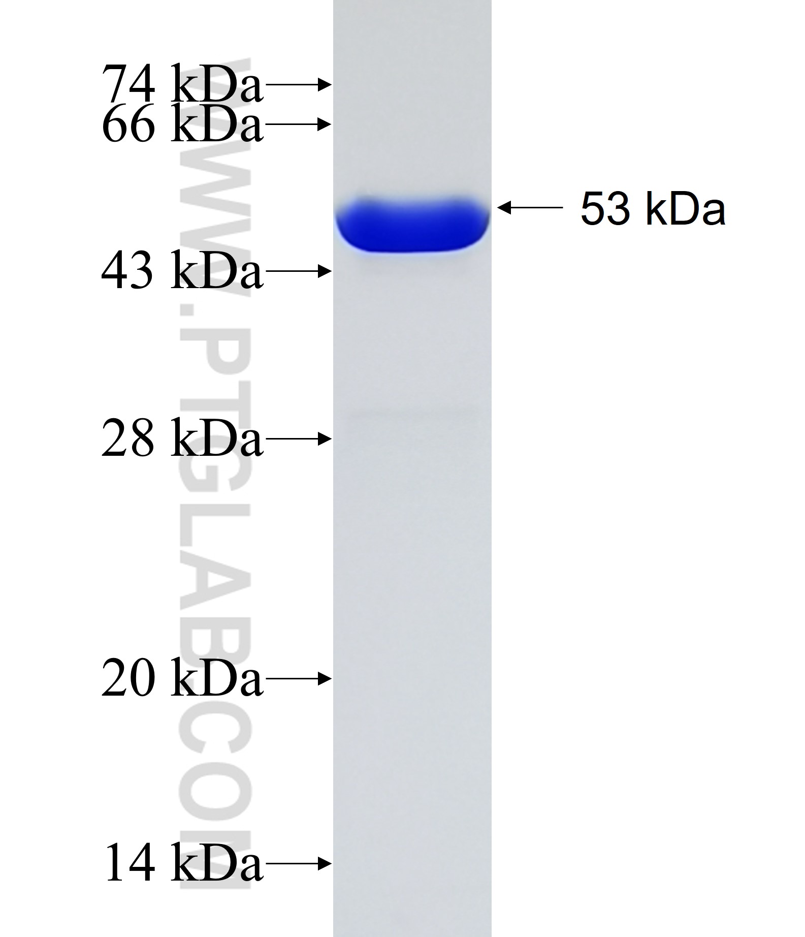 DCUN1D1 fusion protein Ag1440 SDS-PAGE