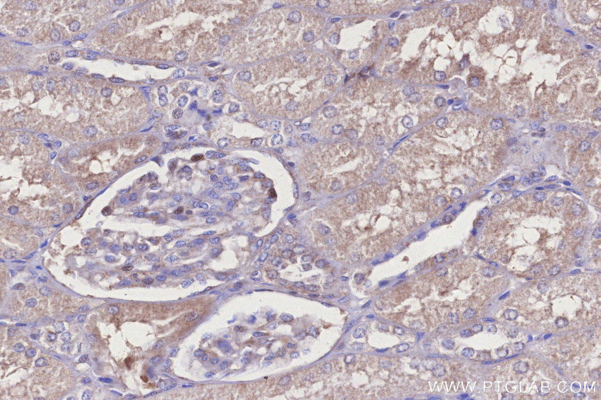 IHC staining of human kidney using 31696-1-AP (same clone as 31696-1-PBS)