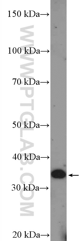 WB analysis of MCF-7 using 26356-1-AP