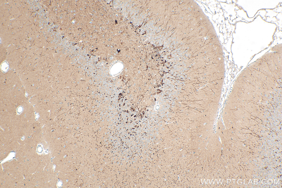 IHC staining of rat brain using 13925-1-AP
