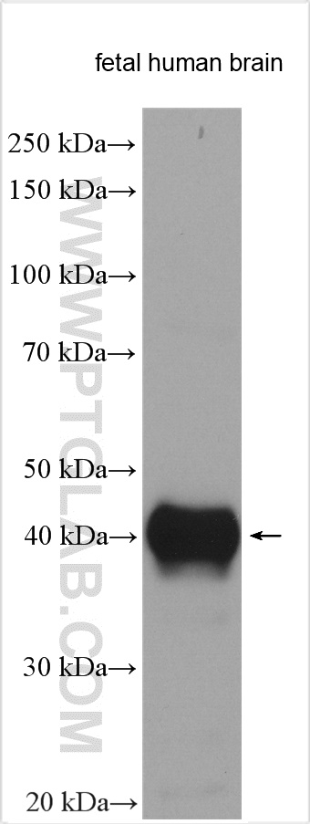 WB analysis using 13925-1-AP