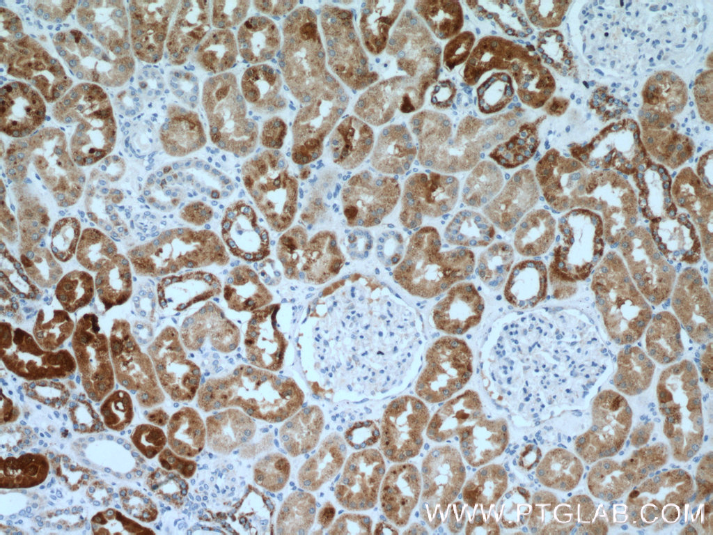 IHC staining of human kidney using 15188-1-AP