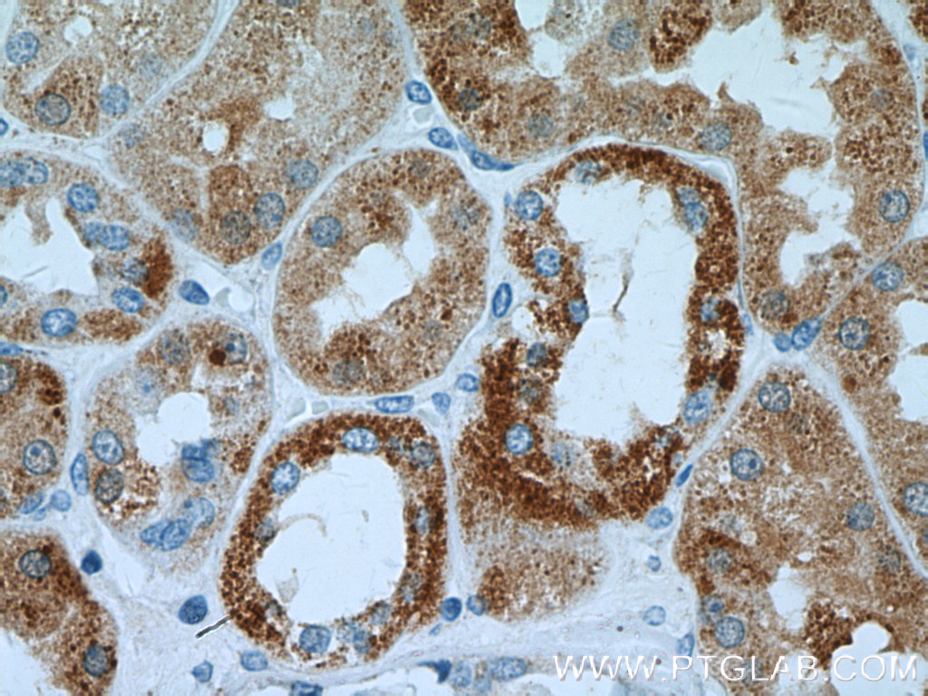 IHC staining of human kidney using 15188-1-AP