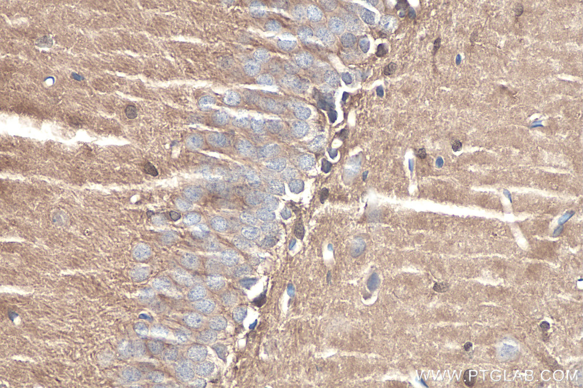 IHC staining of rat brain using 30108-1-AP