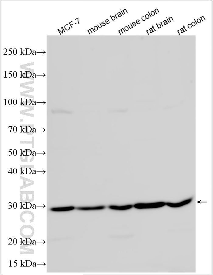WB analysis using 14966-1-AP