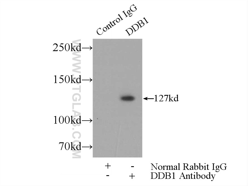 IP experiment of Jurkat using 11380-1-AP