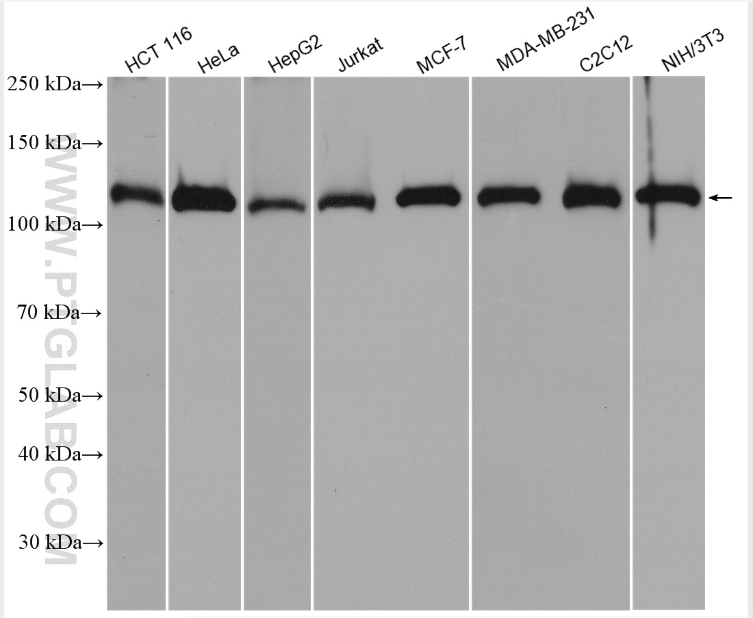 WB analysis using 11380-1-AP