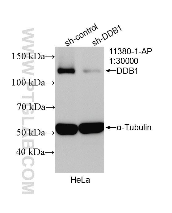 WB analysis of HeLa using 11380-1-AP WB analysis of HeLa using 11380-1-AP