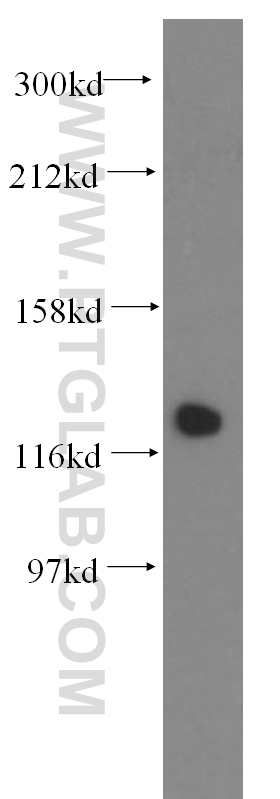 DDB1 Polyclonal antibody