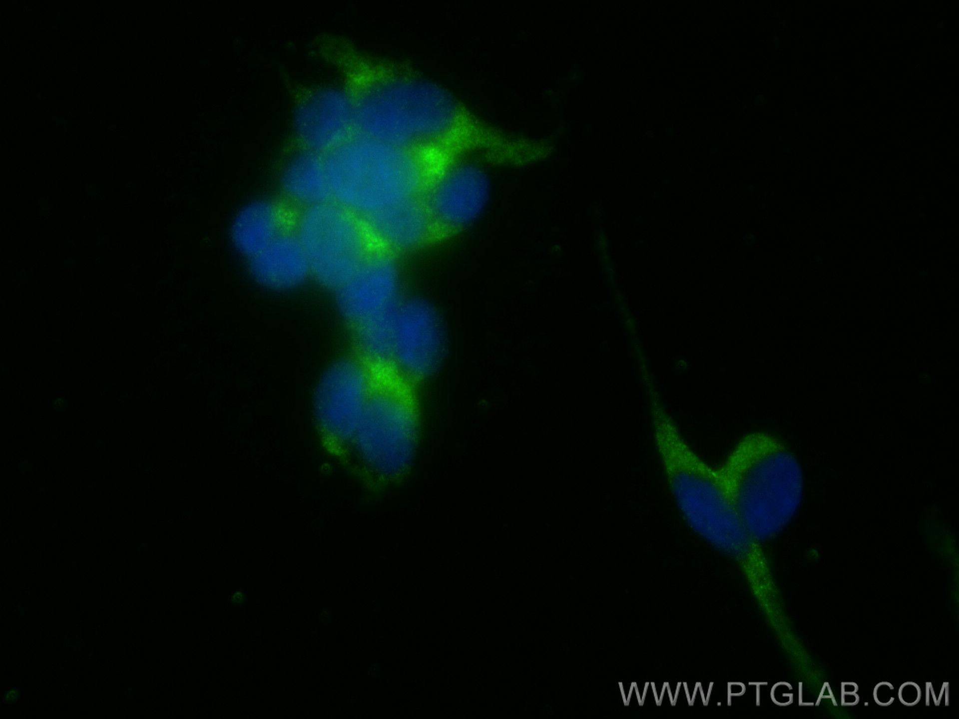 IF Staining of SH-SY5Y using 10166-1-AP