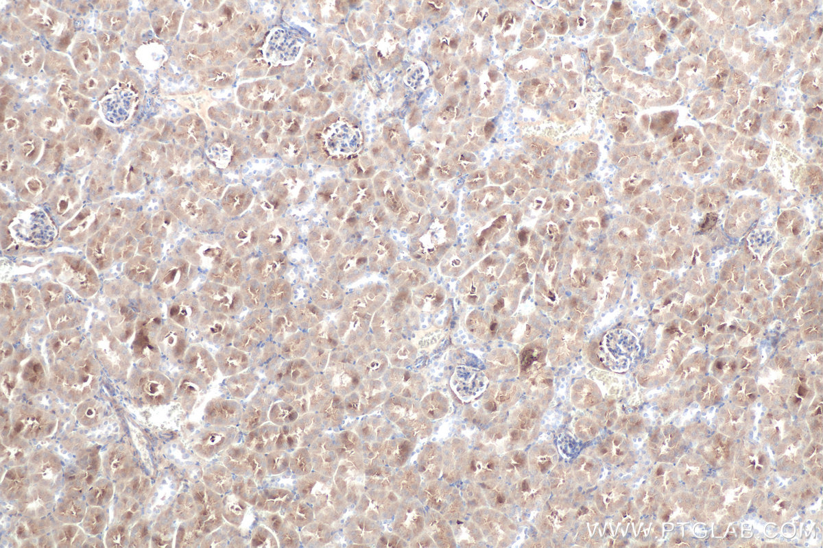 IHC staining of mouse kidney using 10166-1-AP