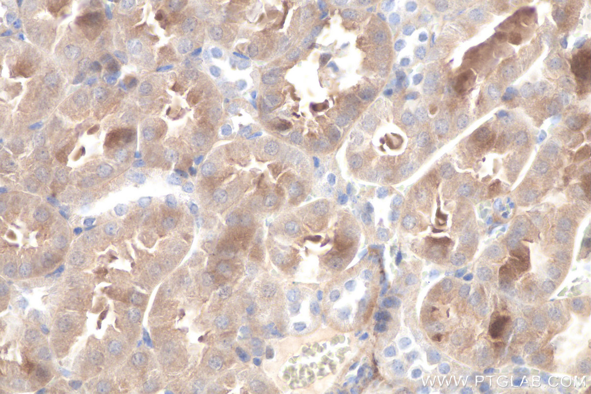 IHC staining of mouse kidney using 10166-1-AP