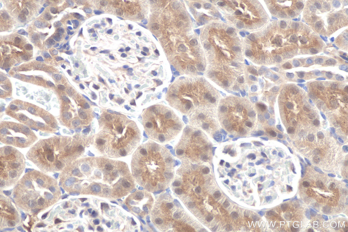 IHC staining of rat kidney using 10166-1-AP