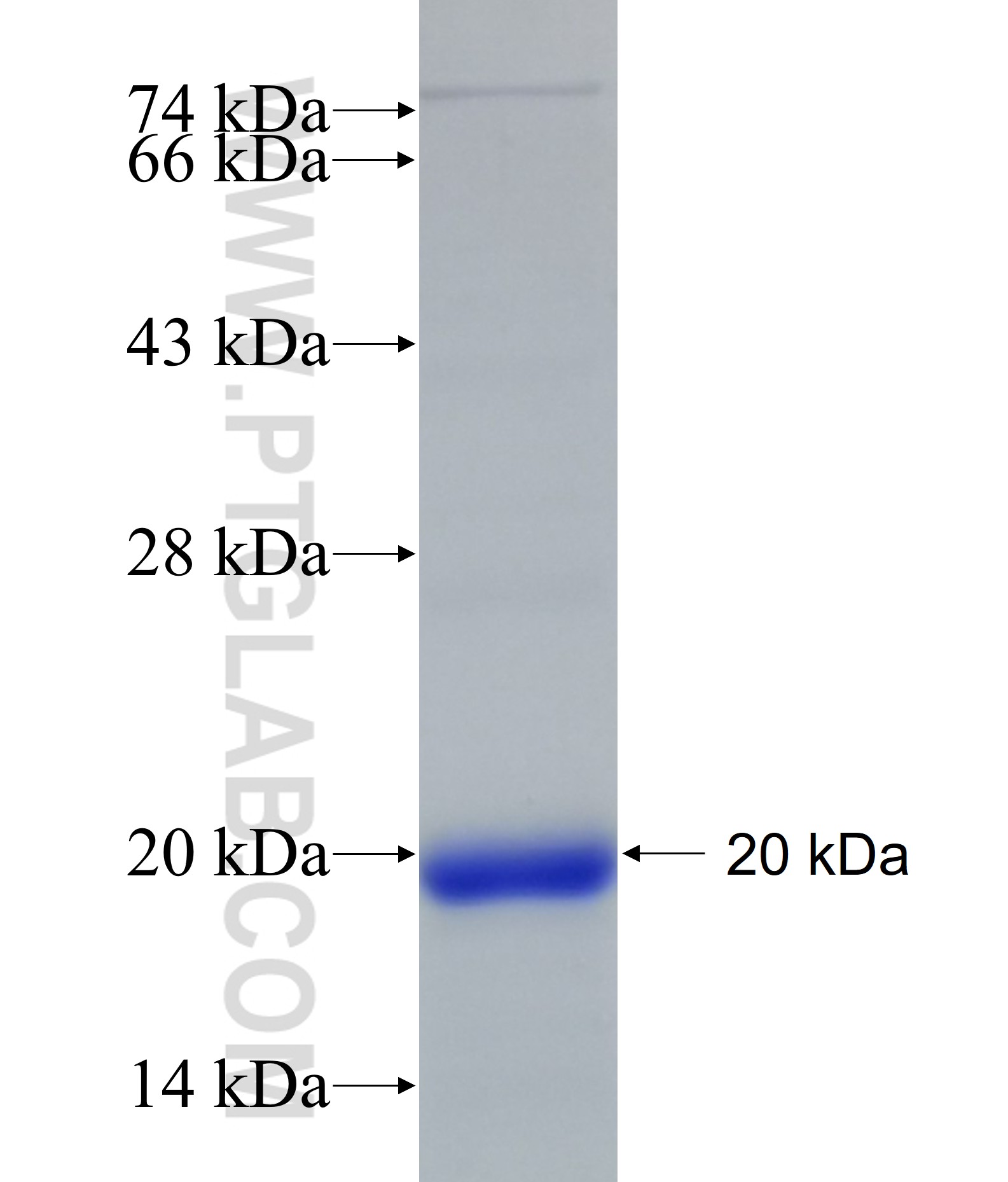 DDHD2 fusion protein Ag18391 SDS-PAGE