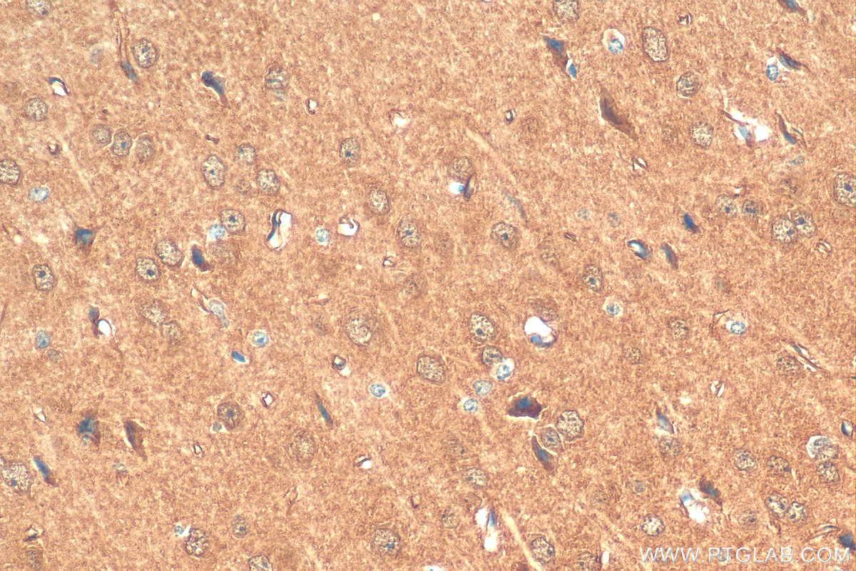 IHC staining of mouse brain using 15204-1-AP