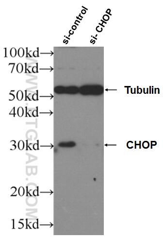 WB analysis of HeLa using 15204-1-AP