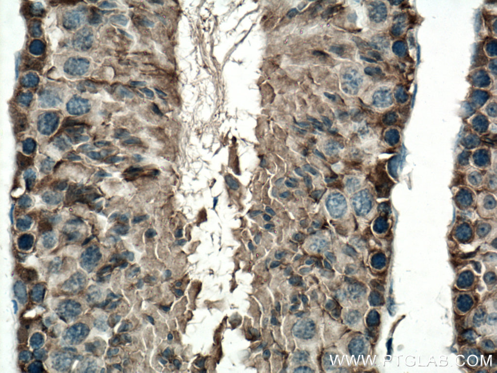 IHC staining of mouse testis using 14916-1-AP