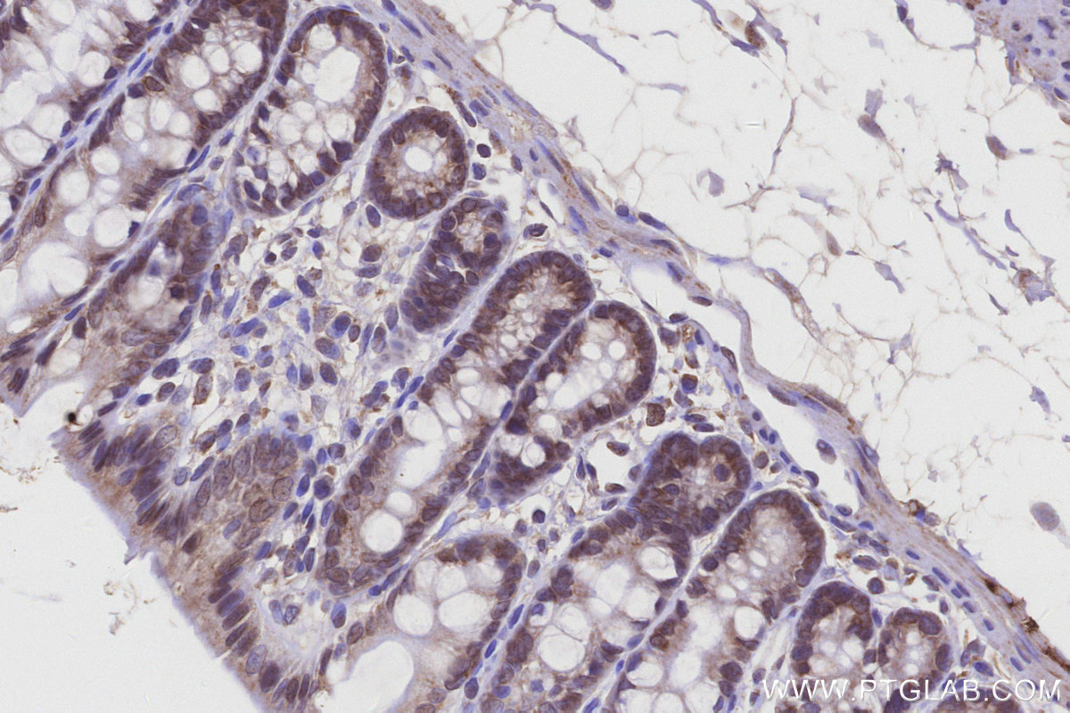 IHC staining of rat colon using 14916-1-AP IHC staining of rat colon using 14916-1-AP