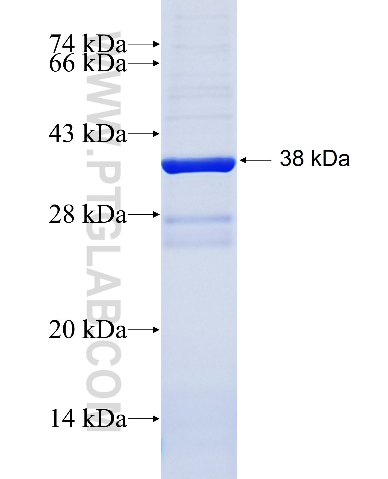 DDR2 fusion protein Ag28183 SDS-PAGE DDR2 fusion protein Ag28183 SDS-PAGE
