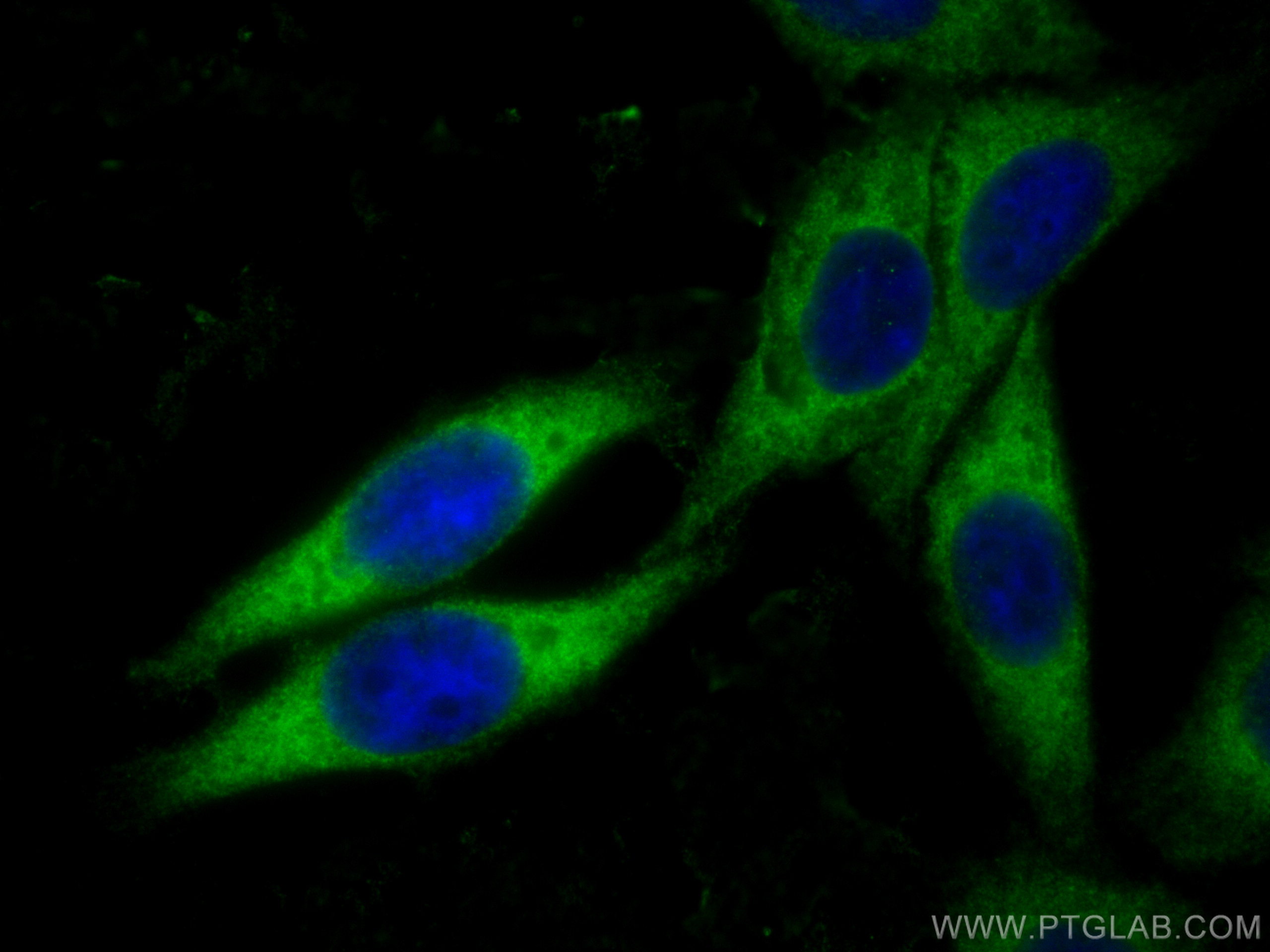 IF Staining of HepG2 using 21445-1-AP