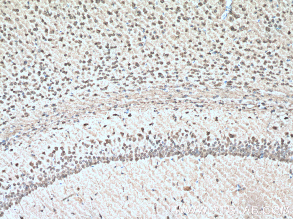 IHC staining of mouse brain using 21445-1-AP