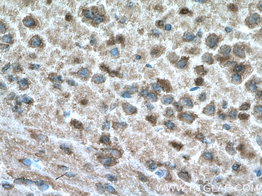 IHC staining of mouse brain using 21445-1-AP