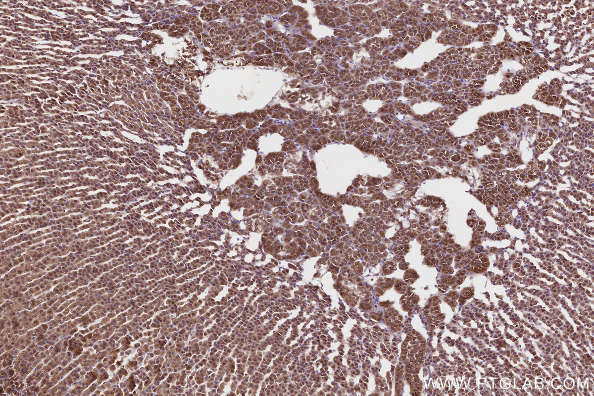 IHC staining of rat adrenal gland using 21445-1-AP IHC staining of rat adrenal gland using 21445-1-AP