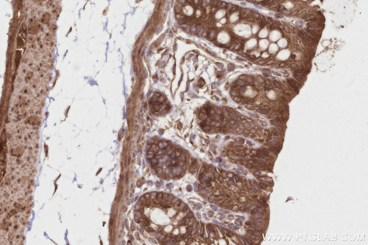 IHC staining of rat colon using 21445-1-AP IHC staining of rat colon using 21445-1-AP