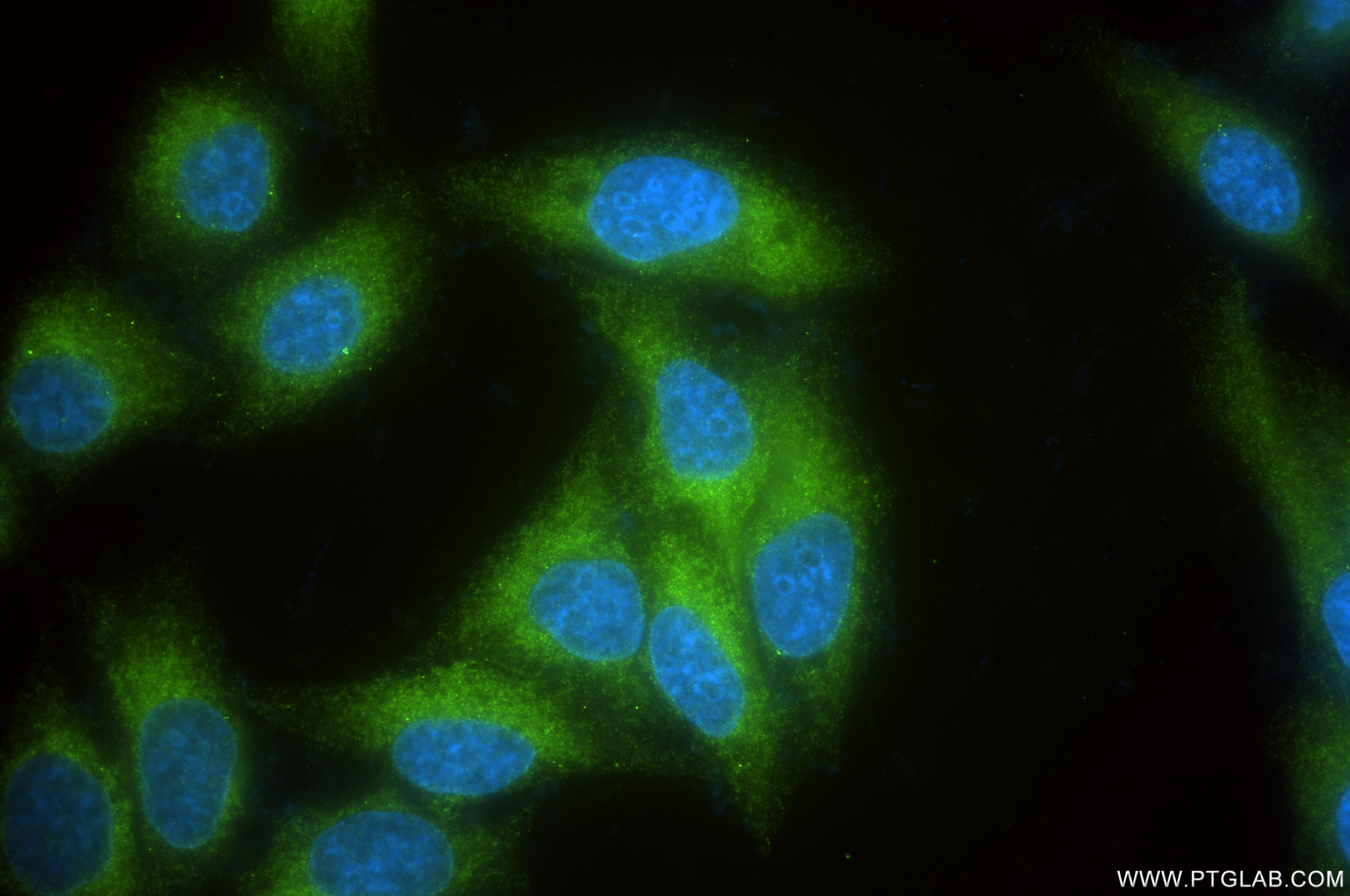 Immunofluorescent analysis of (-20°C Ethanol) fixed HepG2 cells using DDRGK1 antibody (<a class='green' href='/productredirect?CatalogNo=86667-2-RR' target='_blank'>86667-2-RR</a>, Clone: 251582G2 ) at dilution of 1:500 and CoraLite®488-Conjugated Goat Anti-Rabbit IgG(H+L) (<a class='green' href='/productredirect?CatalogNo=SA00013-2' target='_blank'>SA00013-2</a>). This data was developed using the same antibody clone with 86667-2-PBS in a different storage buffer formulation. IF Staining of HepG2 using 86667-2-RR (same clone as 86667-2-PBS)