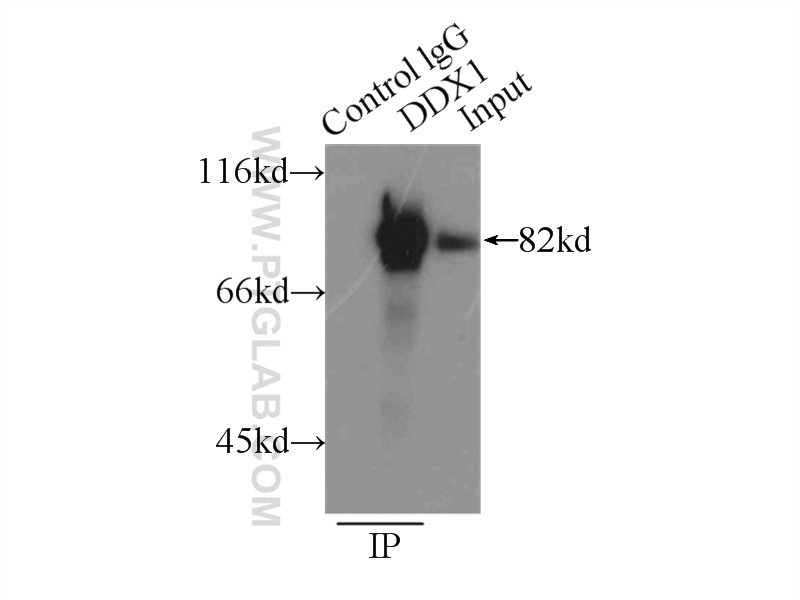 IP experiment of PC-3 using 11357-1-AP