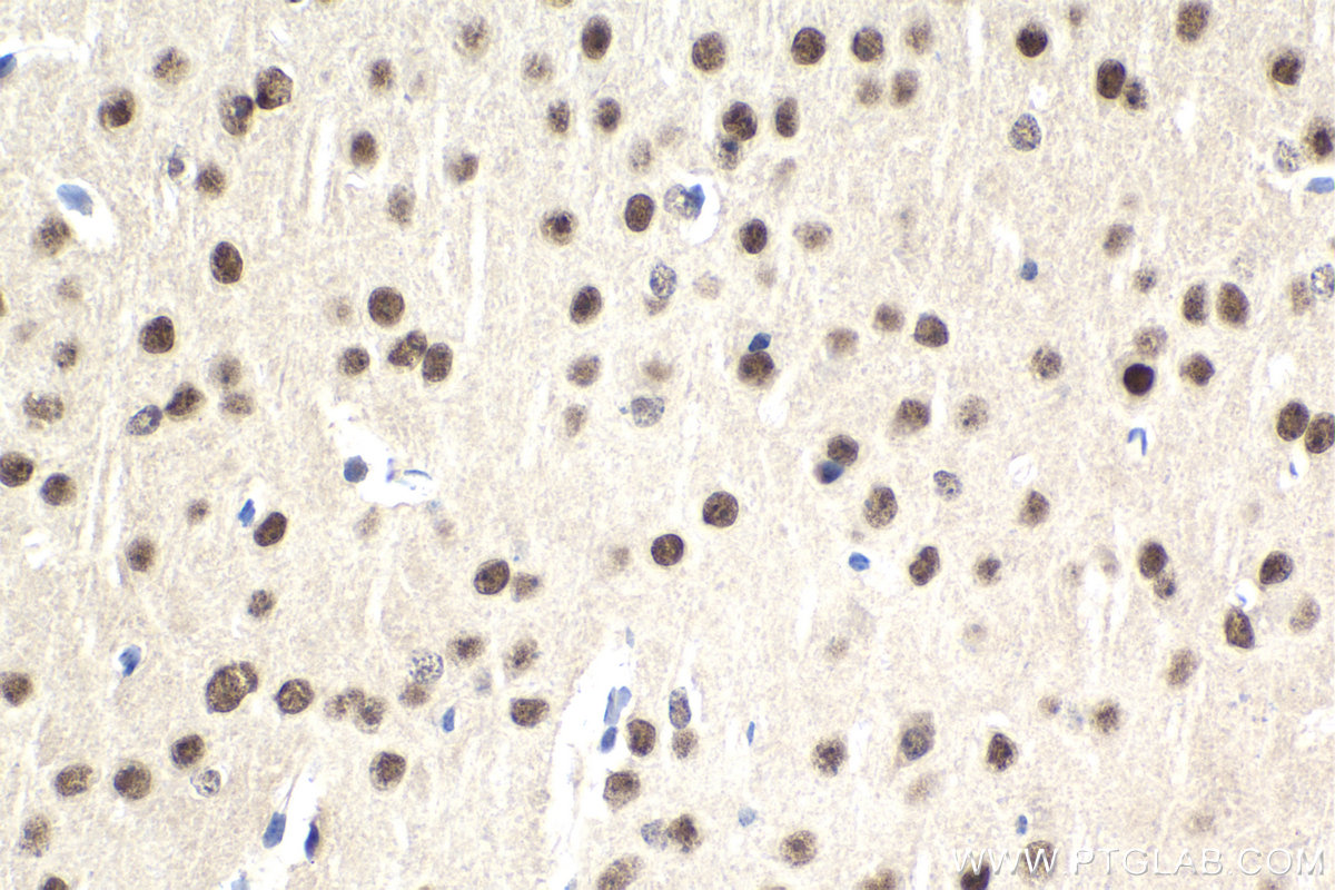 IHC staining of mouse brain using 67991-1-Ig (same clone as 67991-1-PBS)