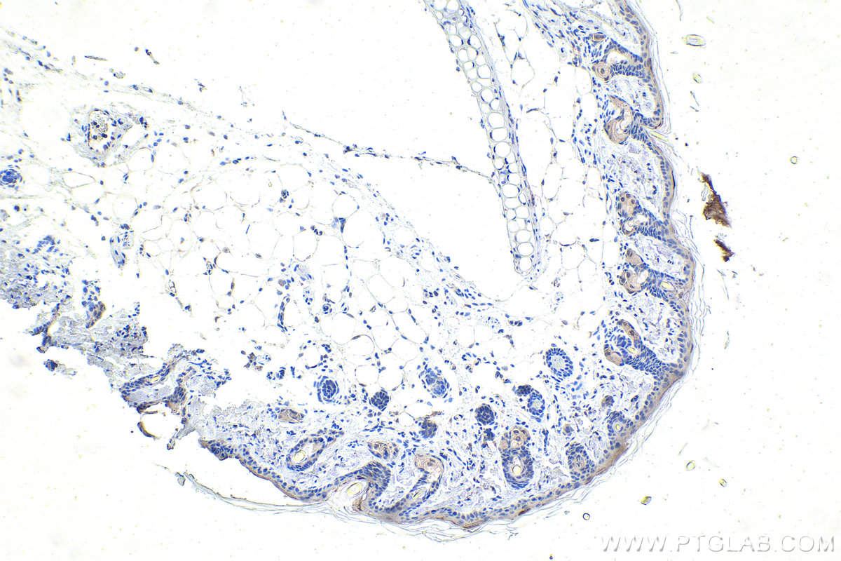 IHC staining of rat skin using 67991-1-Ig (same clone as 67991-1-PBS)