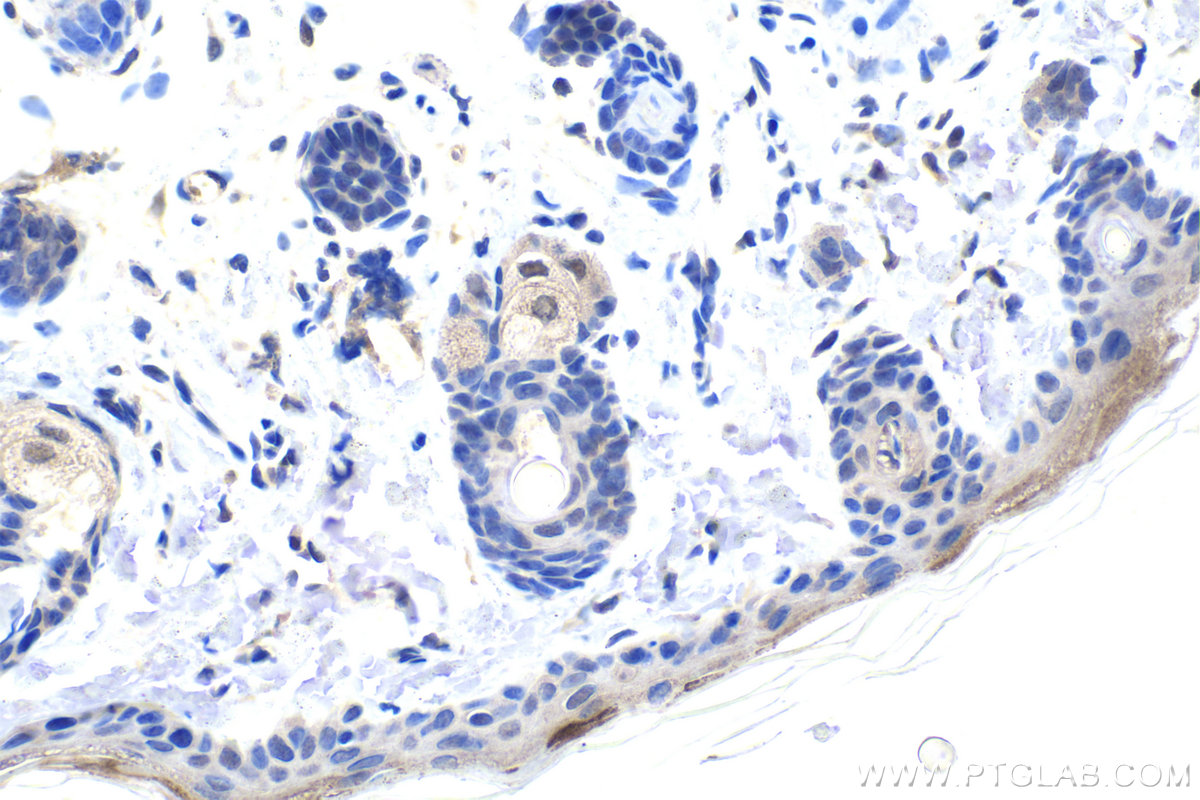 IHC staining of rat skin using 67991-1-Ig (same clone as 67991-1-PBS)