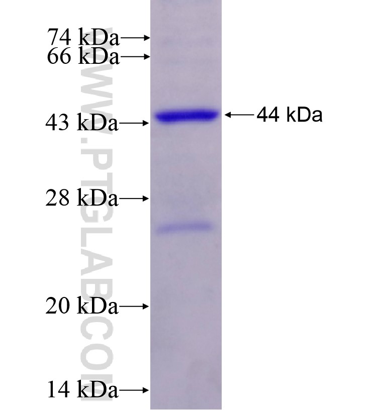 DDX1 fusion protein Ag16774 SDS-PAGE